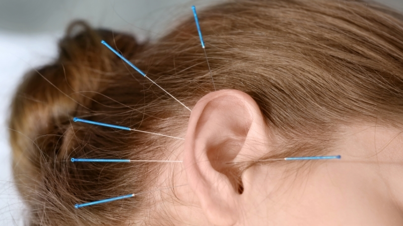 O Poder da Acupuntura Auricular para Transformar seu Bem-Estar