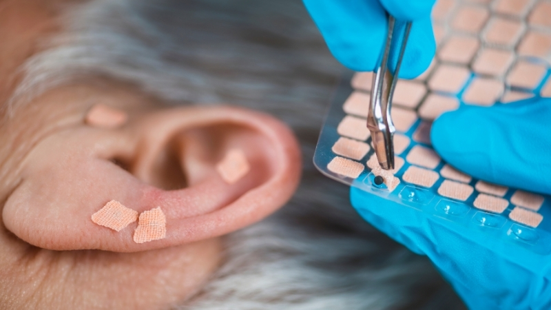 Tratamento para dor: O Poder da Acupuntura Auricular para Transformar seu Bem-Estar