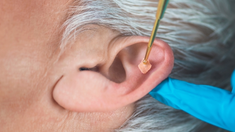 Blog: Acupuntura Auricular: Um Pequeno Toque, Uma Grande Mudança