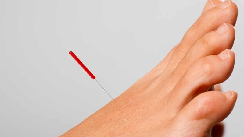 Blog: Acupuntura Blog: Acupuntura